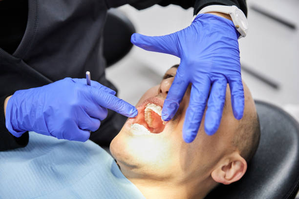 Best Emergency Root Canal Treatment in Herndon, VA